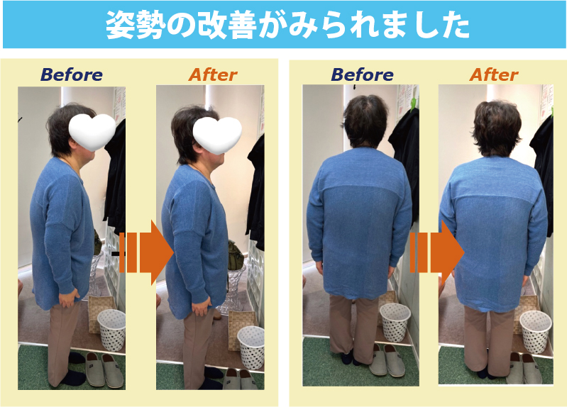 デンタルリフレクソロジーのビフォーアフター画像